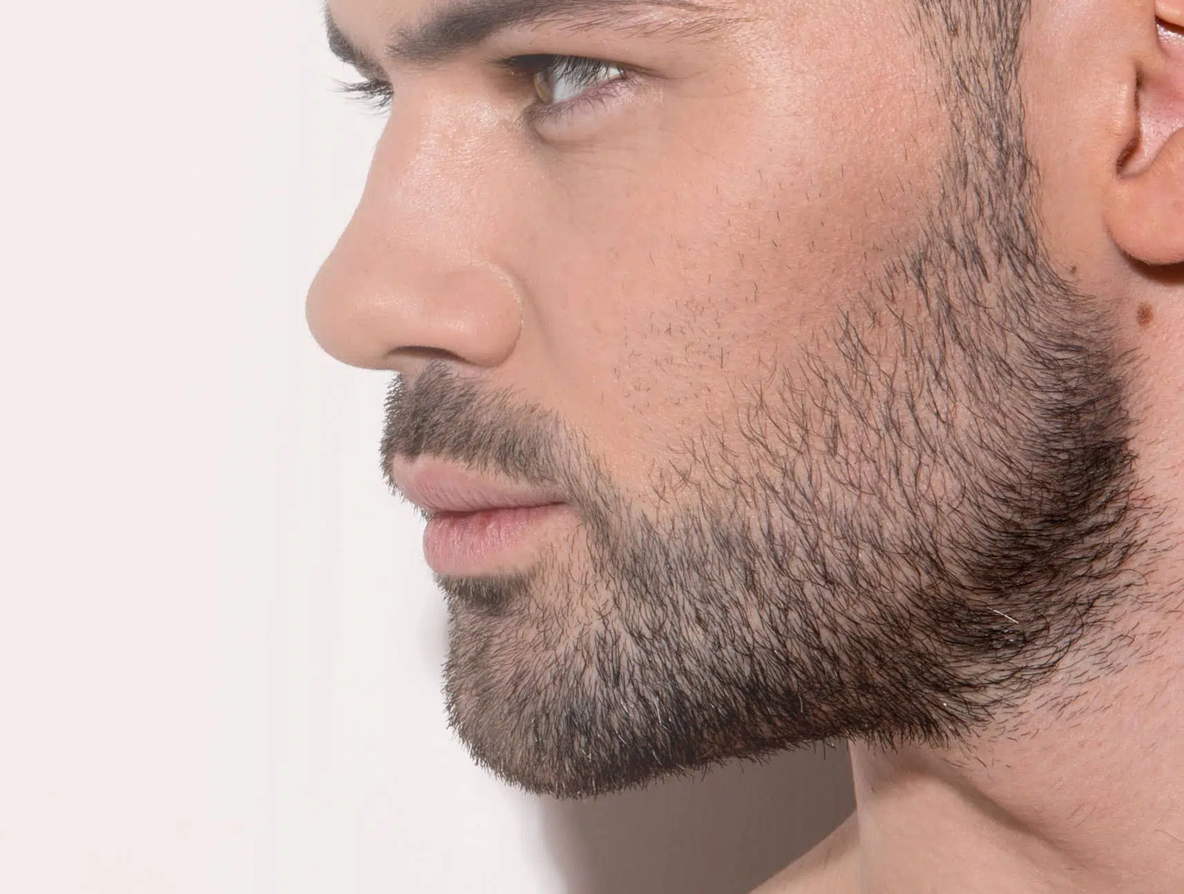 Épilation laser barbe
