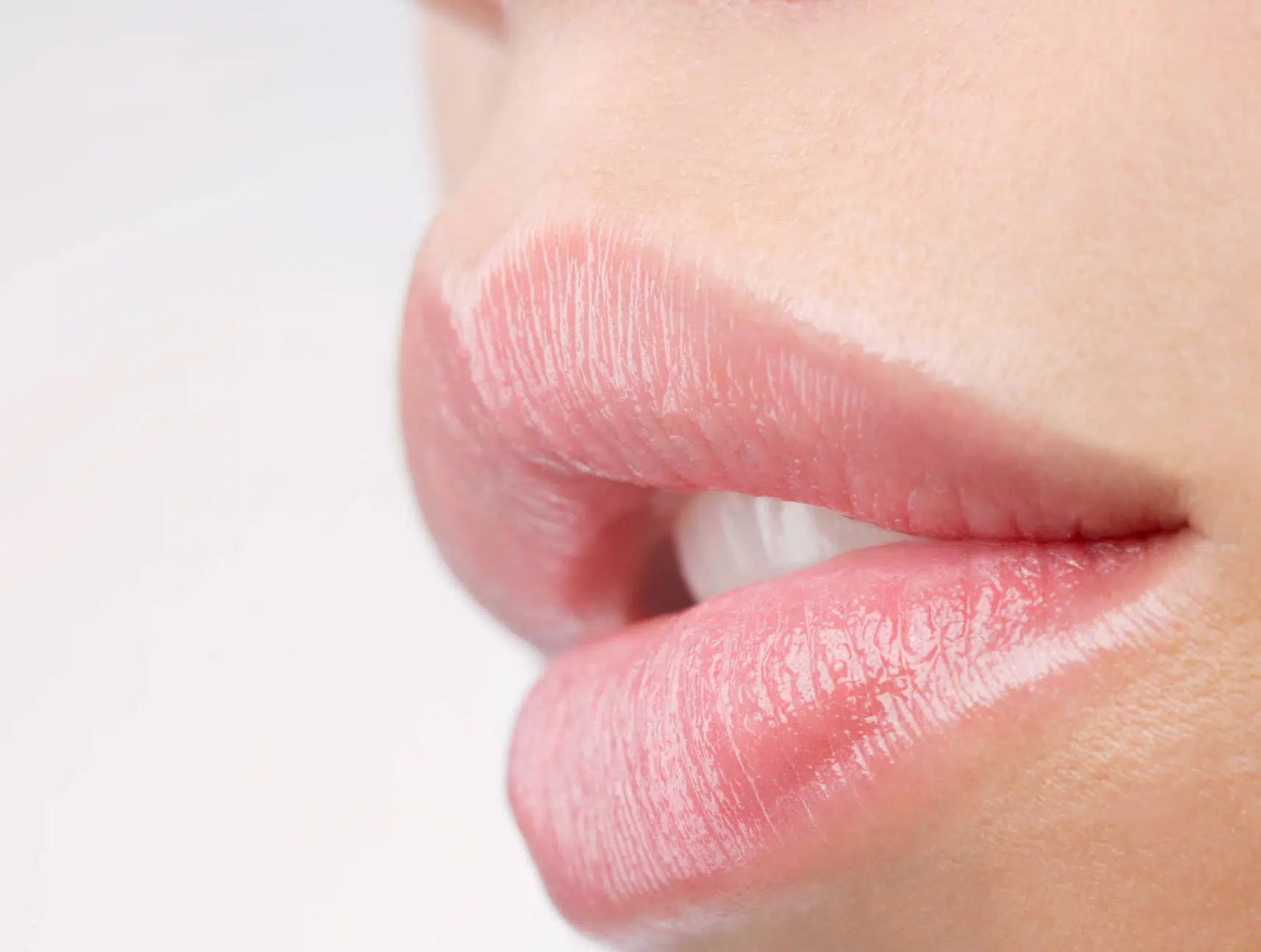 Épilation laser lèvre